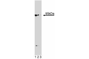 Western blot analysis of Neurotensin Receptor 3 on a PFSK-1 cell lysate (Human neuroectodermal tumor line, ATCC CRL-2060). (Sortilin 1 antibody  (AA 300-422))