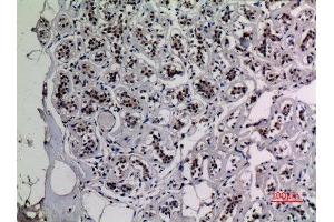 Immunohistochemistry (IHC) analysis of paraffin-embedded Human Breast, antibody was diluted at 1:100. (NF-kB p65 antibody  (acLys218))