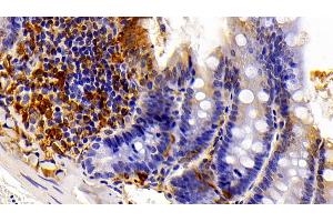 Detection of GAL3 in Rat Colon Tissue using Polyclonal Antibody to Galectin 3 (GAL3) (Galectin 3 antibody  (AA 1-262))