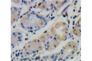 Used in DAB staining on fromalin fixed paraffin-embedded Stomach tissue (UBD antibody  (AA 1-165))