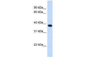 ACBD4 antibody used at 1 ug/ml to detect target protein. (ACBD4 antibody  (N-Term))
