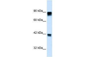 WB Suggested Anti-RB1 Antibody Titration: 0. (Retinoblastoma 1 antibody  (C-Term))
