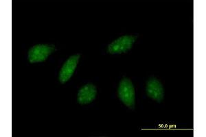 Immunofluorescence of purified MaxPab antibody to HLX on HeLa cell.