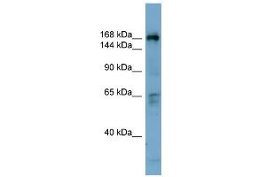WB Suggested Anti-DOCK2 Antibody Titration: 0. (DOCK2 antibody  (Middle Region))