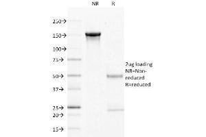 SDS-PAGE Analysis Purified CD22 Mouse Monoclonal Antibody (LPFS2/1611). (CD27 antibody)