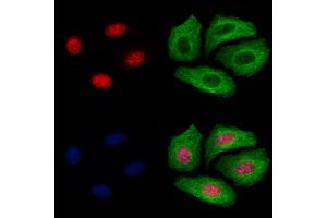 ABIN6255193 and ABIN6267396 staining Hela cells(4h of LPS treatment) by IF/ICC. (GATA1 antibody  (pSer310))