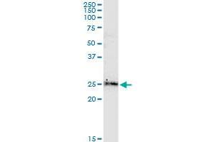 BCL2L2 monoclonal antibody (M01), clone 2E4. (BCL2L2 antibody  (AA 1-193))