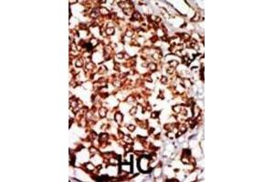 Immunohistochemistry (IHC) image for anti-Nuclear Receptor Binding Protein 1 (NRBP1) antibody (ABIN3003671)