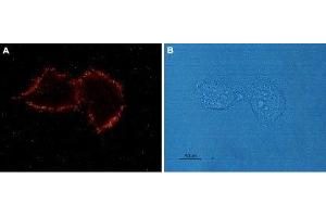 Immunocytochemistry (ICC) image for anti-Angiotensin II Receptor, Type 1 (AGTR1) (AA 4-18), (Extracellular) antibody (ABIN7042922)