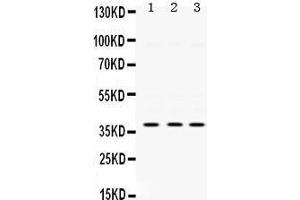 Western Blotting (WB) image for anti-Protein Kinase, AMP-Activated, beta 1 Non-Catalytic Subunit (PRKAB1) (AA 32-68), (N-Term) antibody (ABIN3043359) (PRKAB1 antibody  (N-Term))