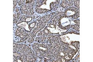 IHC analysis of HNRNPL using anti-HNRNPL antibody (ABIN4886624). (HNRNPL antibody  (C-Term))