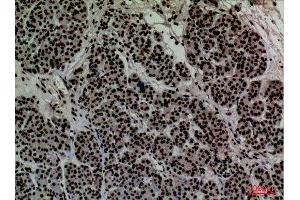 Immunohistochemistry (IHC) analysis of paraffin-embedded Human Pancreas, antibody was diluted at 1:100. (CD2 antibody  (N-Term))