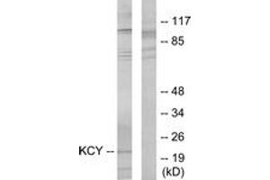 Western blot analysis of extracts from HeLa cells, using KCY Antibody. (KCY (AA 1-50) antibody)