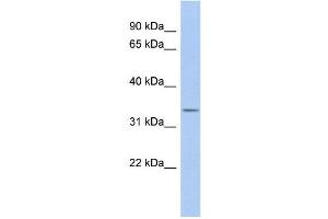 WB Suggested Anti-ODF4 Antibody Titration: 0. (ODF4 antibody  (N-Term))