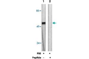 Western blot analysis of extracts from 293 cells, treated with PBS (60 mins), using SOX9 polyclonal antibody . (SOX9 antibody  (Ser181))