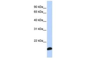 Image no. 1 for anti-Peroxiredoxin 5 (PRDX5) (C-Term) antibody (ABIN6741267) (Peroxiredoxin 5 antibody  (C-Term))