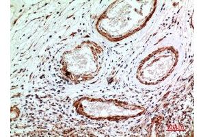 Immunohistochemistry (IHC) analysis of paraffin-embedded Human Brain, antibody was diluted at 1:100. (IL1R1 antibody  (N-Term))