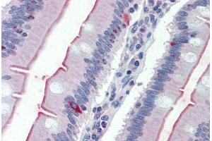Anti-SLC5A1 / SGLT1 antibody  ABIN1049342 IHC staining of human small intestine. (SLC5A1 antibody  (Internal Region))