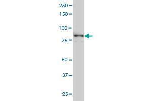 TACC3 antibody  (AA 1-100)