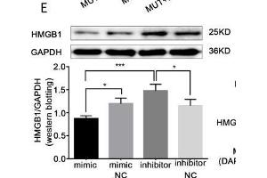 HMGB1 was a direct target of miR-339-5p. (GAPDH antibody)