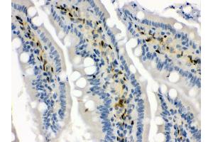 Anti- Hsp70 Picoband antibody, IHC(P) IHC(P): Rat Intestine Tissue (HSP70 1A antibody  (C-Term))