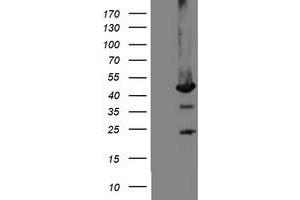 Western Blotting (WB) image for anti-Mannose Phosphate Isomerase (MPI) antibody (ABIN1499546) (MPI antibody)