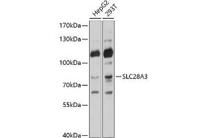 Western blot analysis of extracts of various cell lines, using SLC28 antibody (ABIN6133437, ABIN6147944, ABIN6147945 and ABIN6214531) at 1:1000 dilution. (SLC28A3 antibody  (AA 612-691))