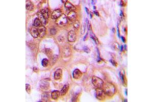 Immunohistochemistry (IHC) image for anti-Cyclin-Dependent Kinase Inhibitor 1B (p27, Kip1) (CDKN1B) (C-Term), (pSer187) antibody (ABIN7300500)