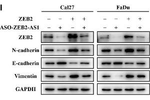 Western Blotting (WB) image for anti-Vimentin (VIM) antibody (ABIN2854814)