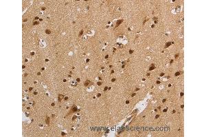 Immunohistochemistry of Human brain  using KCNG4 Polyclonal Antibody at dilution of 1:40 (KCNG4 antibody)