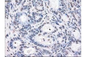 Image no. 3 for anti-P450 (Cytochrome) Oxidoreductase (POR) antibody (ABIN1497743) (POR antibody)