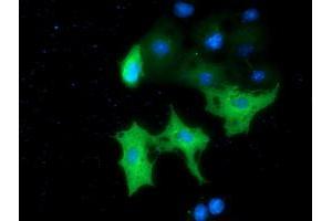 Anti-MTMR14 mouse monoclonal antibody (ABIN2453334) immunofluorescent staining of COS7 cells transiently transfected by pCMV6-ENTRY MTMR14 (RC207732). (MTMR14 antibody)