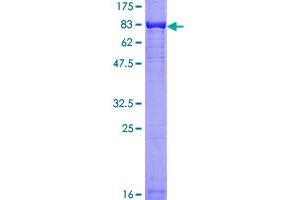 Image no. 1 for V-Akt Murine Thymoma Viral Oncogene Homolog 1 (AKT1) (AA 1-480) protein (GST tag) (ABIN1344778)