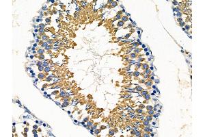 ABIN6260022 and ABIN6276440 at 1/100 staining Rat testis tissue by IHC-P.