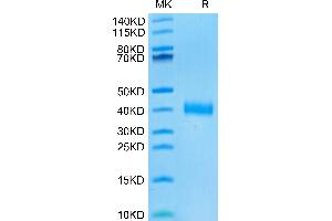 SARS-CoV-2 Spike RBD (Omicron BA. (SARS-CoV-2 Spike Protein (BA.4 - Omicron, BA.5 - Omicron, RBD) (His tag))
