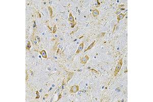 Immunohistochemistry of paraffin-embedded mouse brain using FN1 Antibody (ABIN4903688) at dilution of 1:100 (40x lens). (Fibronectin 1 antibody)