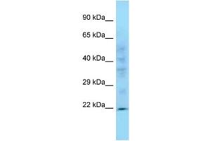WB Suggested Anti-Ppic Antibody Titration: 1. (PPIC antibody  (C-Term))