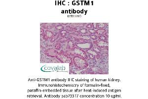 Image no. 1 for anti-Glutathione S-Transferase mu 1 (GSTM1) (AA 1-159) antibody (ABIN1735304) (GSTM1 antibody  (AA 1-159))