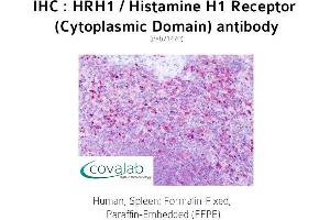 Image no. 1 for anti-Histamine Receptor H1 (HRH1) (3rd Cytoplasmic Domain) antibody (ABIN1735570) (HRH1 antibody  (3rd Cytoplasmic Domain))