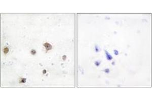 Immunohistochemistry analysis of paraffin-embedded human brain tissue, using JIP2 Antibody. (IB2 antibody  (AA 581-630))