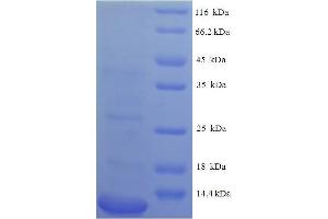 SDS-PAGE (SDS) image for Chemokine (C-C Motif) Ligand 2 (CCL2) (AA 24-96), (partial) protein (His tag) (ABIN1046668)