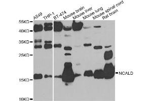 Western blot analysis of extracts of various cell lines, using NCALD antibody (ABIN5975762) at 1/1000 dilution.