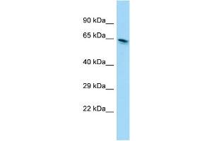 WB Suggested Anti-EEFSEC Antibody Titration: 1.