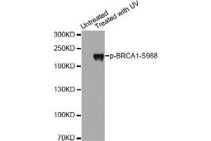Western blot analysis of extracts from Hela cells using Phospho-BRCA1-S988 antibody. (BRCA1 antibody  (pSer988))