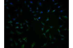 Immunofluorescence staining of U251 cells with ABIN7171646 at 1:100, counter-stained with DAPI. (TBC1D3G antibody  (AA 312-549))
