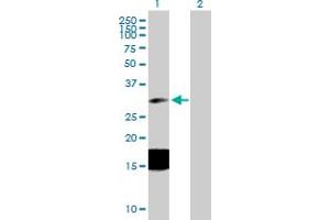 Western Blot analysis of ESM1 expression in transfected 293T cell line by ESM1 MaxPab polyclonal antibody.
