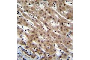 Formalin fixed and paraffin embedded human liver tissue reacted with Pinin / PNN  Antibody  followed by peroxidase conjugation of the secondary antibody and DAB staining. (PNN antibody  (Middle Region))