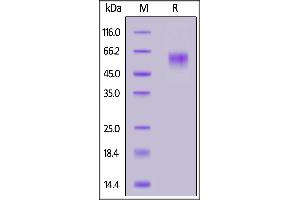 SLC39A6 Protein (AA 21-309) (His tag)