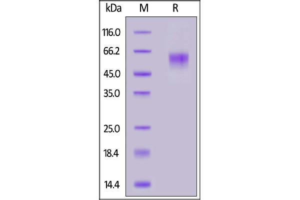 SLC39A6 Protein (AA 21-309) (His tag)