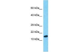 Western Blotting (WB) image for anti-Peptidylprolyl Isomerase A (Cyclophilin A) (PPIA) (Middle Region) antibody (ABIN2791868)